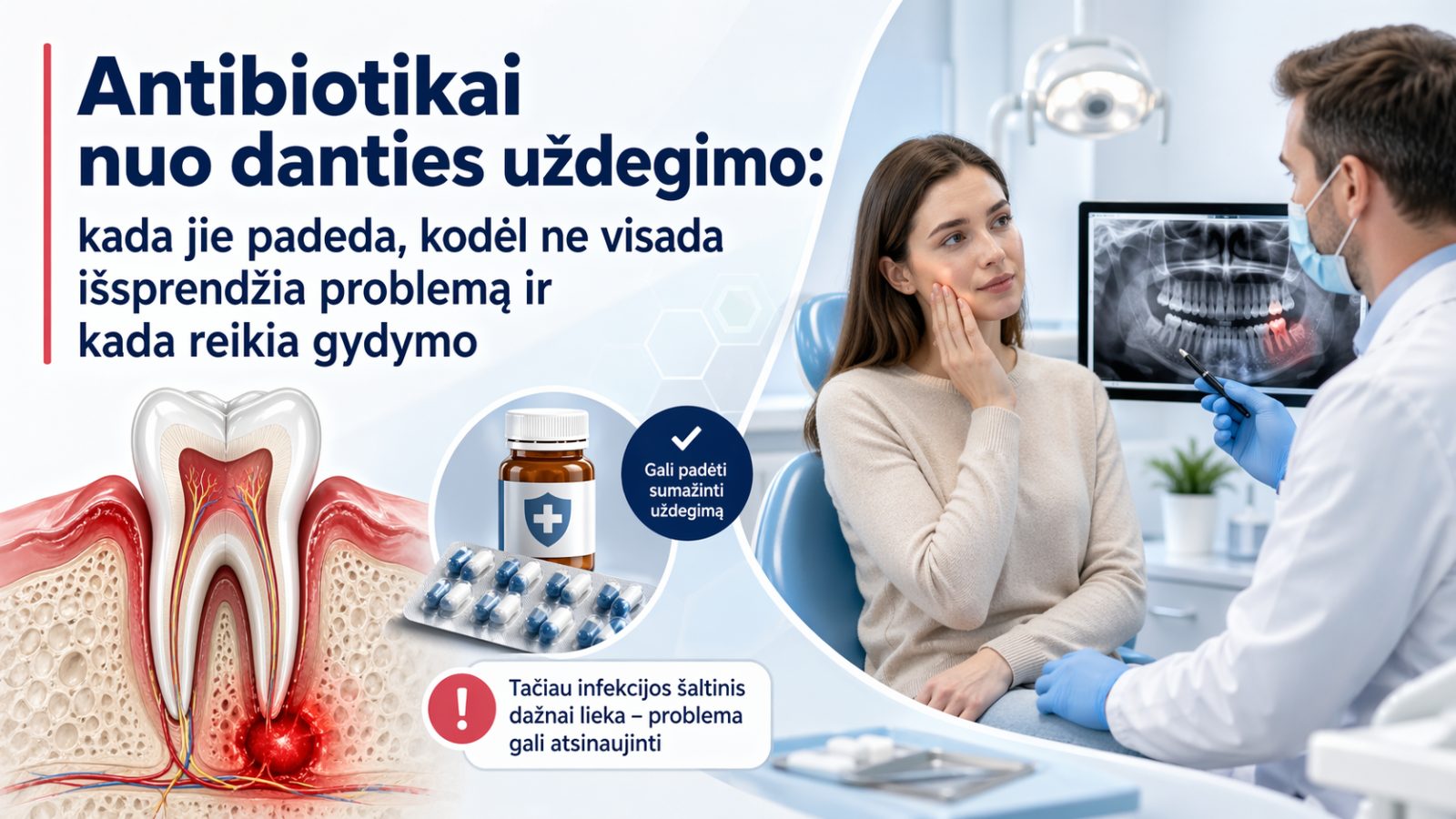 Antibiotikai nuo danties uždegimo: kada jie padeda, kodėl ne visada išsprendžia problemą ir kada reikia gydymo
