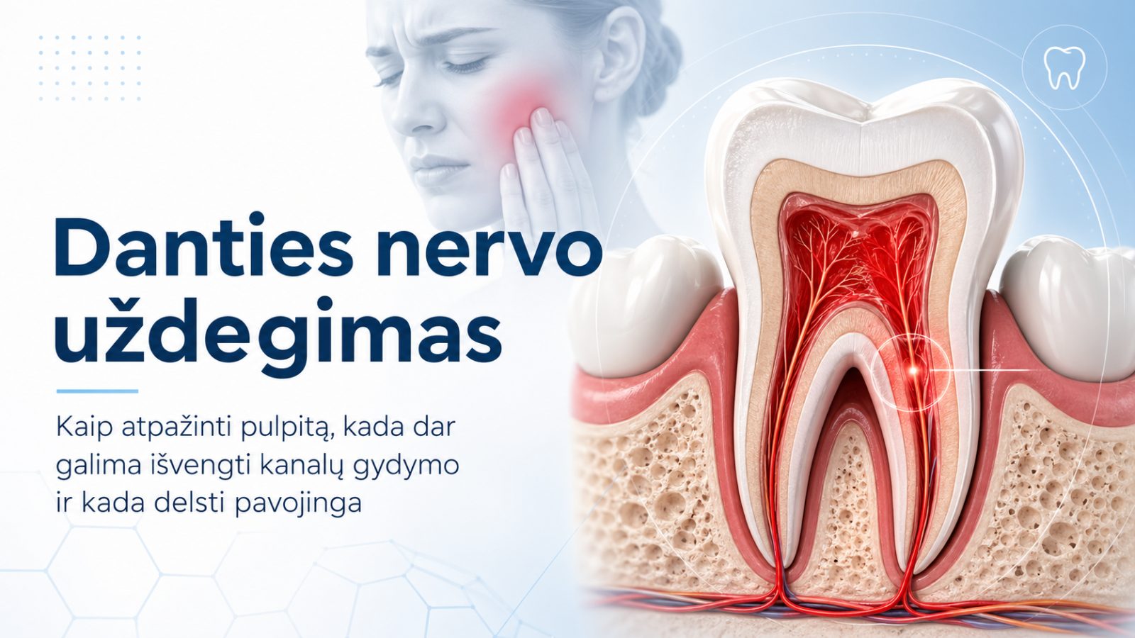 Danties nervo uždegimas (pulpitas): simptomai, gydymas ir kada reikia kanalų gydymo