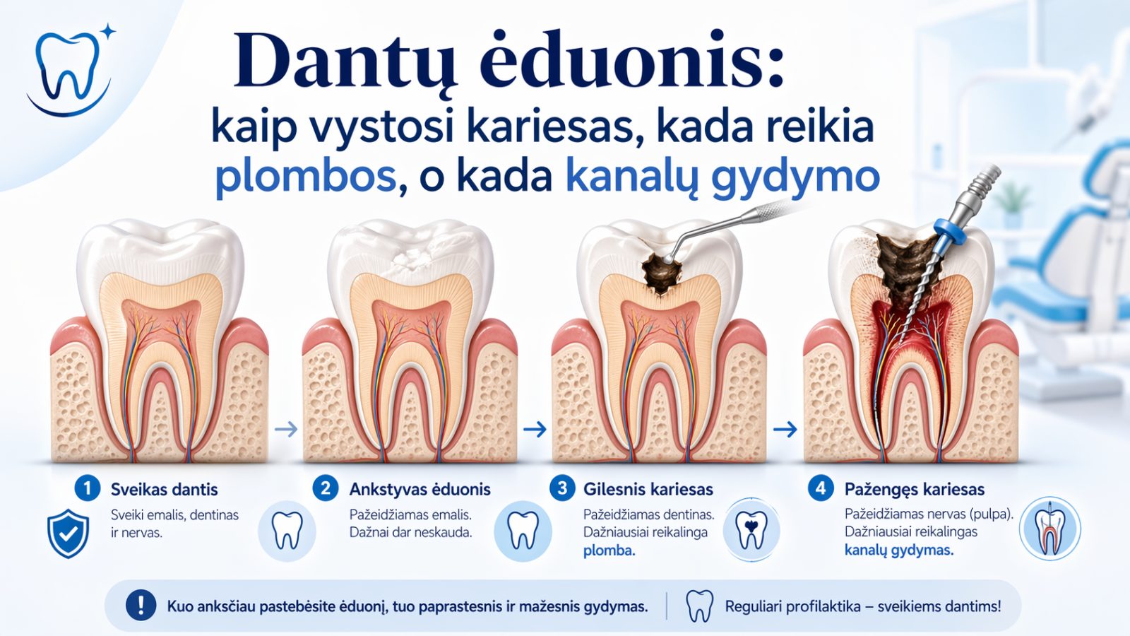 Dantų ėduonis: kaip vystosi kariesas, kada reikia plombos, o kada kanalų gydymo