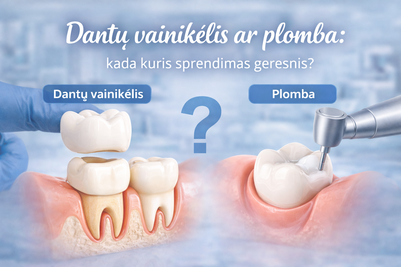 Dantų vainikėlis ar plomba: kada kuris sprendimas geresnis?