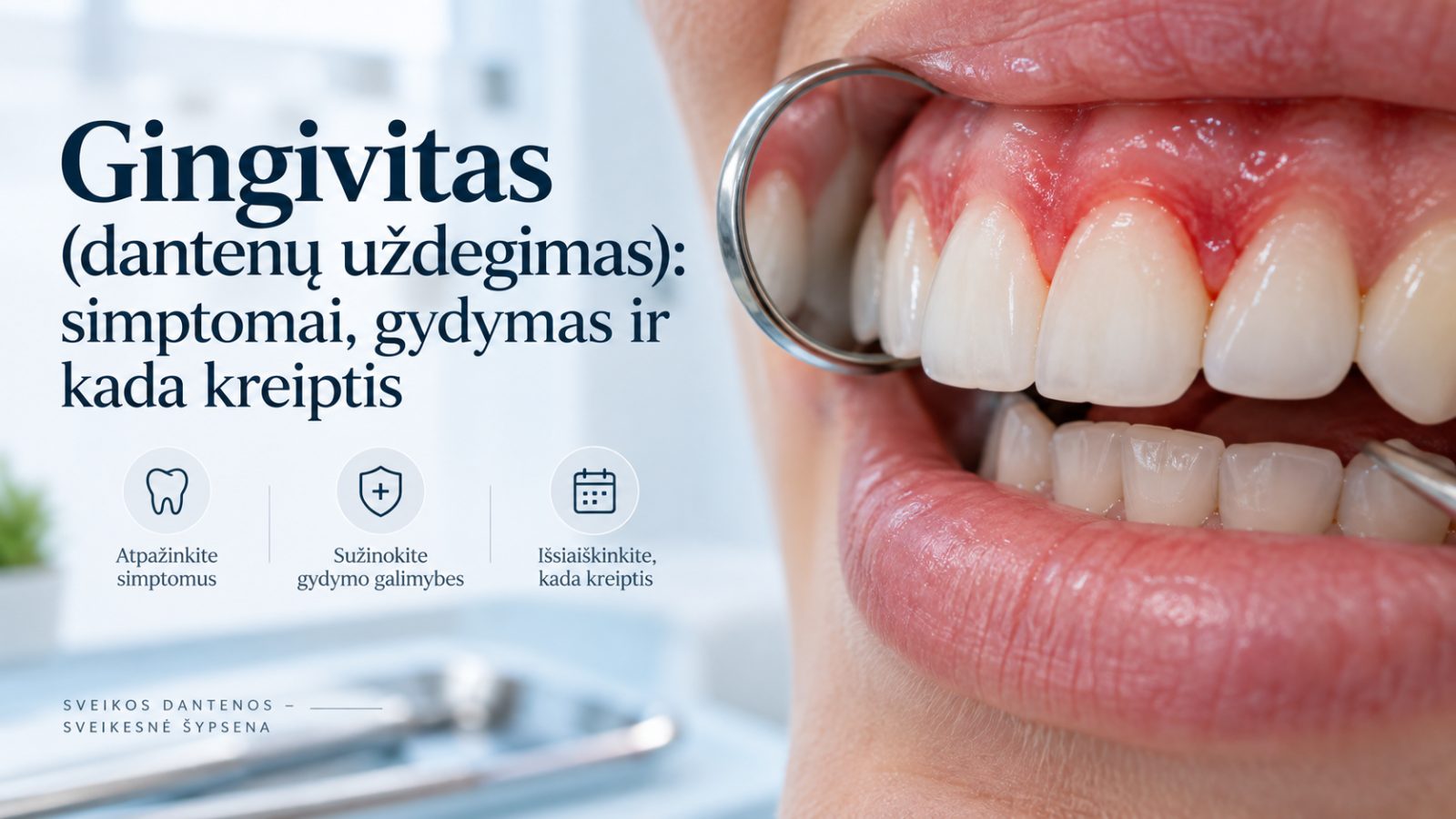 Gingivitas (dantenų uždegimas): simptomai, gydymas ir kada kreiptis