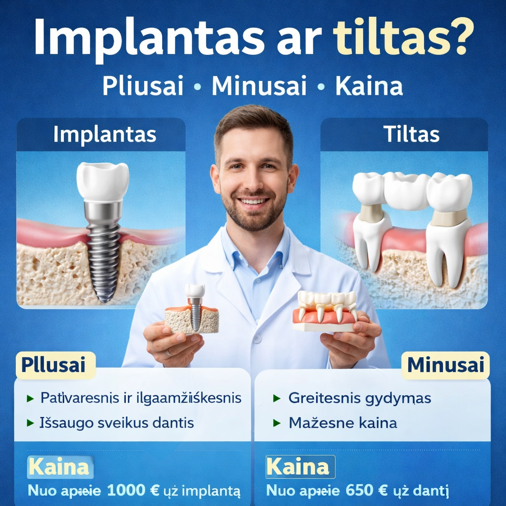 Implantas ar tiltas: ką rinktis? Pliusai, minusai ir kaina
