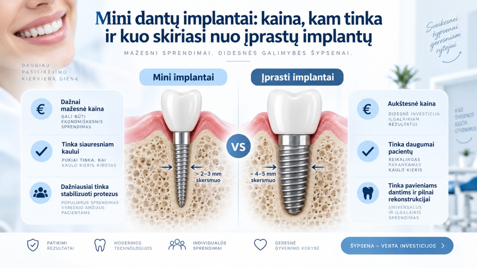 Mini dantų implantai: kaina, kam tinka ir kuo skiriasi nuo įprastų implantų