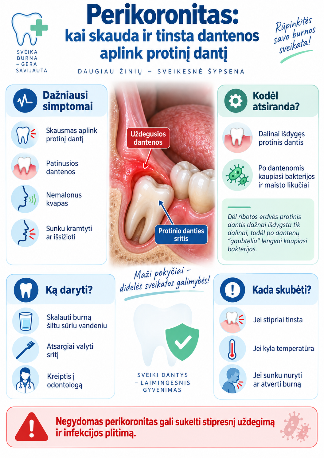 Perikoronitas: kai skauda ir tinsta dantenos aplink protinį dantį